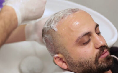 Lavado de cabello postoperatorio