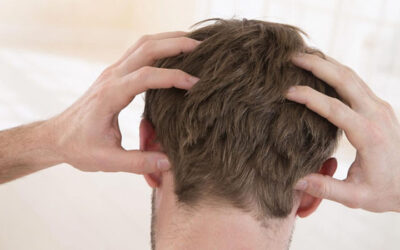 How does itching go away after hair transplantation?